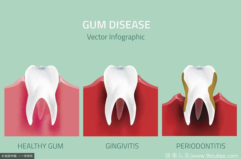 IM电竞平台:僧格林沁:从放羊娃到铁帽子王(图1) IM电竞官网